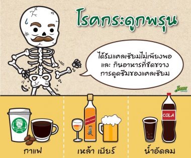 โรคกระดูกพรุน #8 โรคกระดูกพรุน