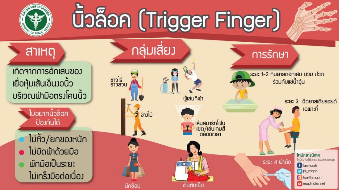 trigger finger
