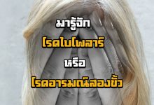 โรคไบโพลาร์