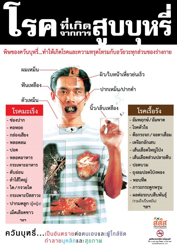 โทษของบุหรี่ #6 โทษของบุหรี่