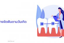 สียางจัดฟันตามวันเกิด สียางจัดฟันสวย ๆ ควรเลือกแบบไหนดี ?