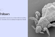 วิธีกําจัดเหา (Pediculosis) ด้วยวิธีธรรมชาติ!