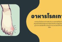 อาหารโรคเกาต์: อาหารที่ควรรับประทานและอาหารที่ควรหลีกเลี่ยง