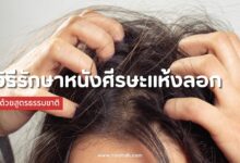 3 วิธีรักษาหนังศีรษะแห้งลอก ด้วยสูตรธรรมชาติอย่างได้ผล!