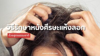 3 วิธีรักษาหนังศีรษะแห้งลอก ด้วยสูตรธรรมชาติอย่างได้ผล!