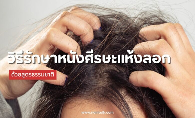 3 วิธีรักษาหนังศีรษะแห้งลอก ด้วยสูตรธรรมชาติอย่างได้ผล!