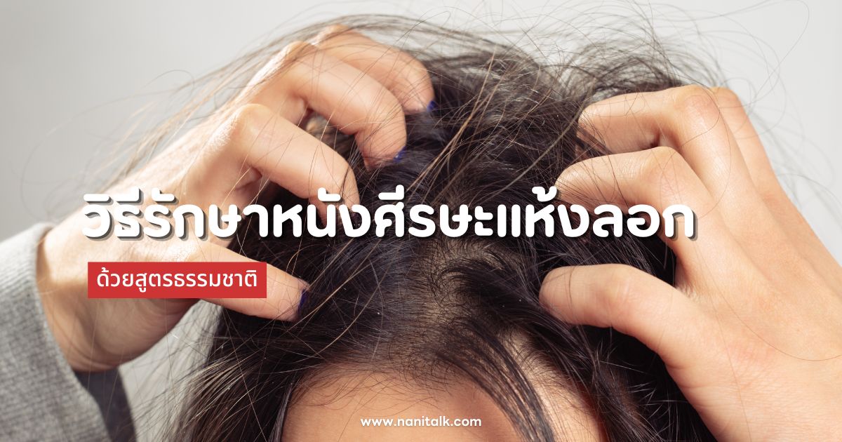 3 วิธีรักษาหนังศีรษะแห้งลอก ด้วยสูตรธรรมชาติอย่างได้ผล!