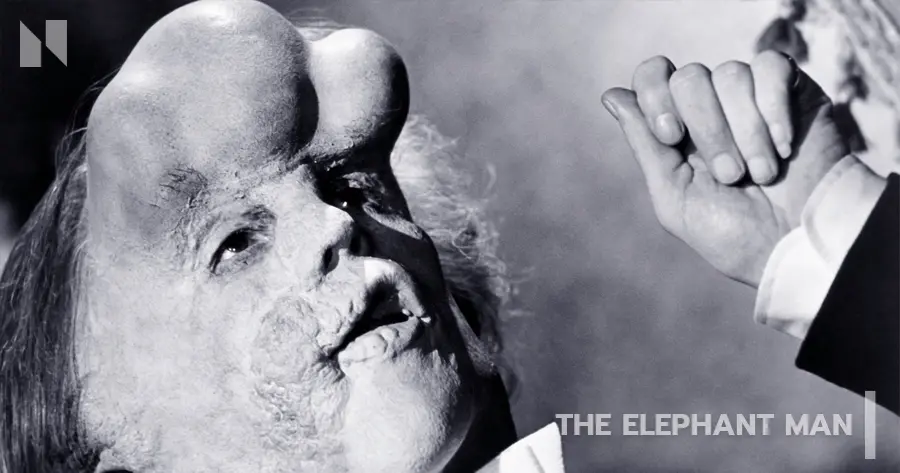 The Elephant Man (1980)
